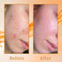 Karrot Oily Skin Range