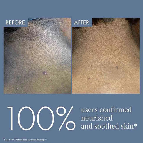 Thriveco Dark Patches Corrector