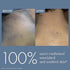 Thriveco Dark Patches Corrector