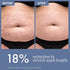 Thriveco Stretch Marks Expert Serum Cream