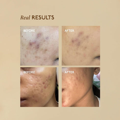 Asaya Advanced Spot Pigmentation Face Serum