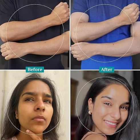 Pilgrim 25% AHA + 2% BHA + 5% PHA Peeling Solution for Face Pigmentation
