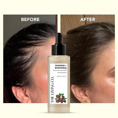 The Living Co Shikakai + Bhringraj Stimulating Scalp Serum