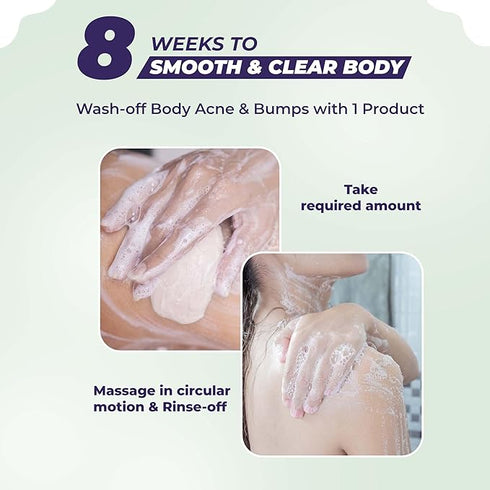 Sanfe Dark Spots|Acne Clearing Body Soap