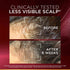 L'Oréal Paris Fall Resist Anti Hair Fall Serum