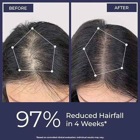 Conscious Chemist® Rosemary Water Spray for Hair Growth