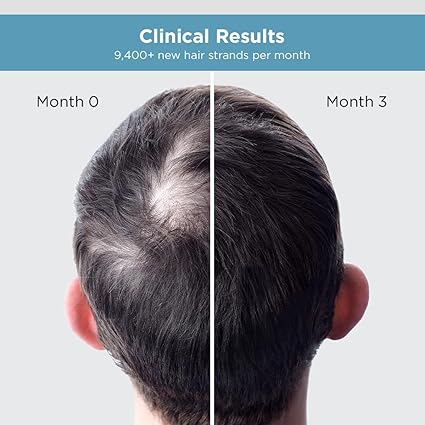 The Man Company Hair Growth Serum For Men