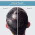 The Man Company Hair Growth Serum For Men