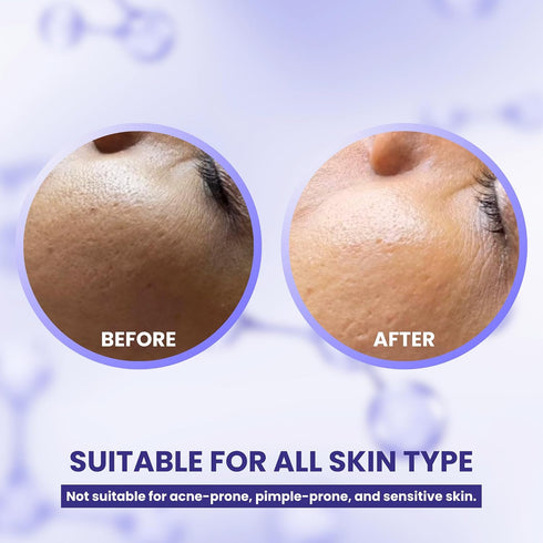 A+ Korean Glass Facial Kit | Suitable For All Skin Types