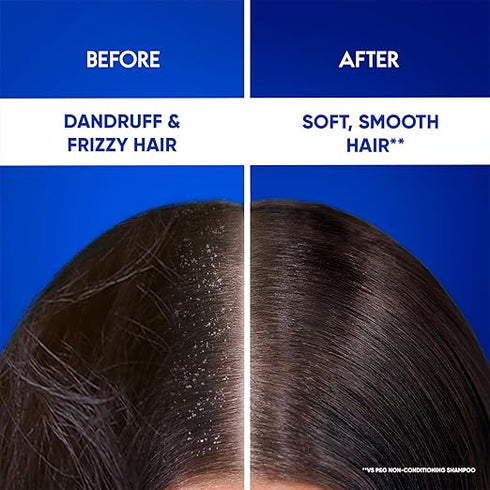 Head & Shoulders 2-in-1 Smooth and Silky Anti Dandruff Shampoo