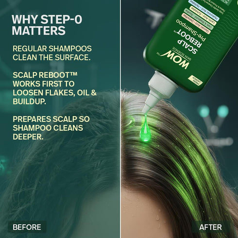 WOW Skin Science Scalp Reboot Pre Shampoo Cleanser Step 0 Gentle Scalp Wash