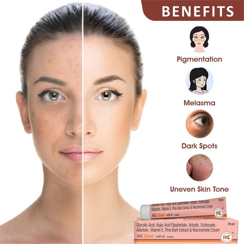 NG Glow Cream - Enriched With Kojic Acid & Glycolic Acid