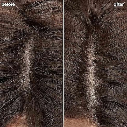 Matrix Biolage Advanced Scalppure Shampoo