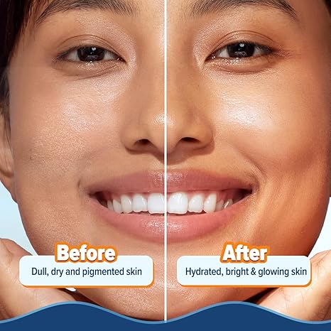 Aqualogica Glow+ Hydra Gel Moisturizer