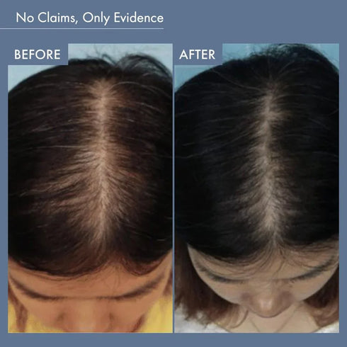 Thriveco Deal Price Rosemary Shampoo Rosemary Conditioner Combo