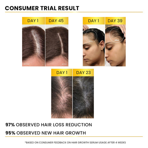 The Skin Story Advanced Hair Growth Serum