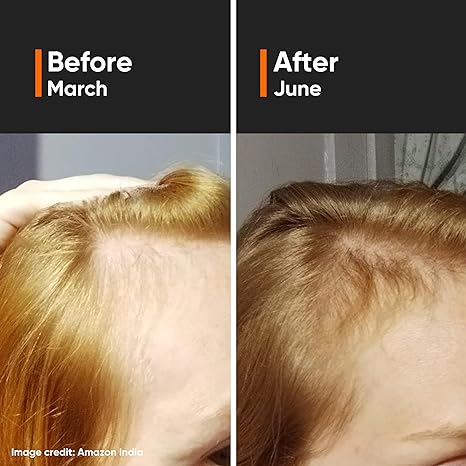 Minimalist Hair Growth Actives 18% Hair Serum