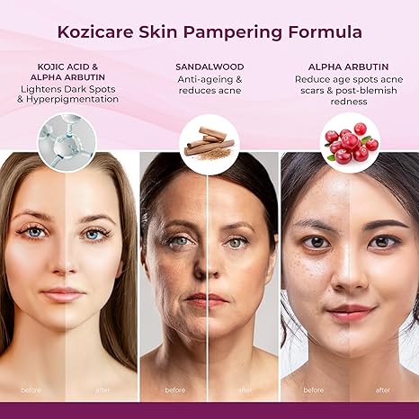 Kozicare Kojic Acid Cream