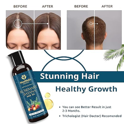 Pure Rosemary Batana Oil for Hair Growth