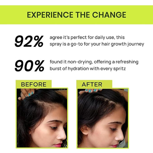 Alps Goodness Rosemary Water for Hair Regrowth