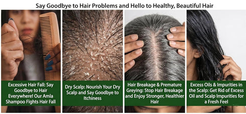 Adhuna Amla Shampoo Stop Hair Loss Grow Thick Hair