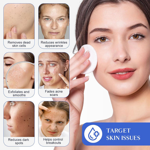 Glycolic Acid Deep Cleaning Facial Pads For Dark Spots