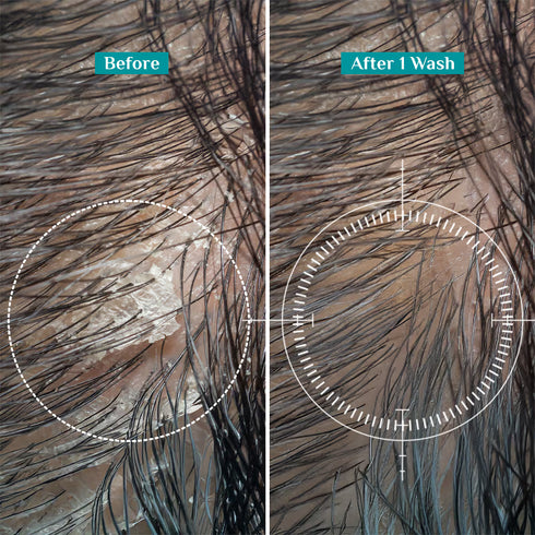 Pilgrim Australian Tea Tree Anti-Dandruff Shampoo