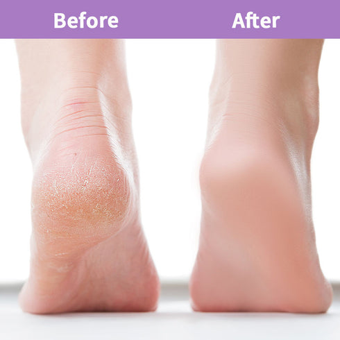 Nykaa Happy Heels Foot Cream - 50gm