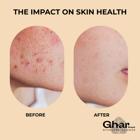 Ghar Soap Face Clean Towel