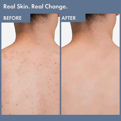 Thriveco Daily Gentle Exfoliating Body Wash