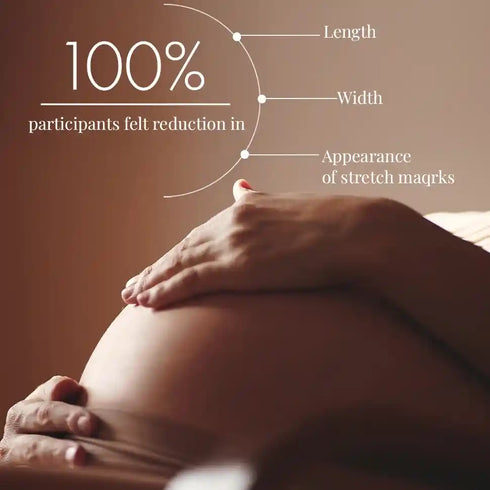 Thriveco Stretch Marks Expert Serum Cream