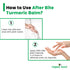 GBL Garden Pvt Ltd After Bite Turmeric Balm