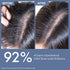Thriveco Anti Dandruff Serum