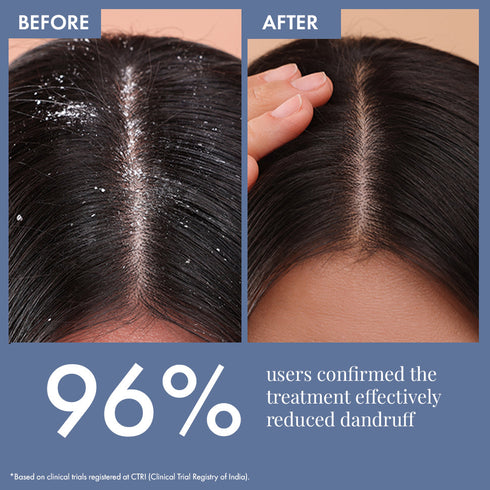 Thriveco Hair Growth Trial Kit