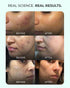 Aqueria Advanced Multi Active French Spot Corrector