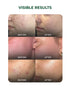 Aqueria Multi Active Discovery Kit for Acne Control Oil Balance and Breakout Prevention