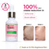 The Pink Foundry Acne & Oil Control Intense Serum with 2% Salicylic Acid