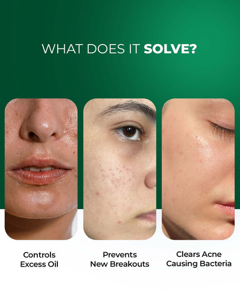 Aqueria French Oil Control Cleanser
