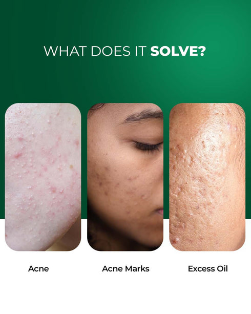 Aqueria Oil Control French Gel Moisturizer