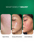 Aqueria Anti Acne Oil Control French Multi Active Serum