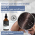 Thriveco Anti Dandruff Serum