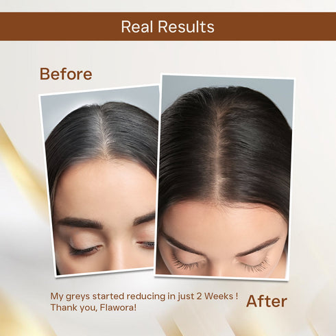 Flawora's Anti Grey Hair Serum