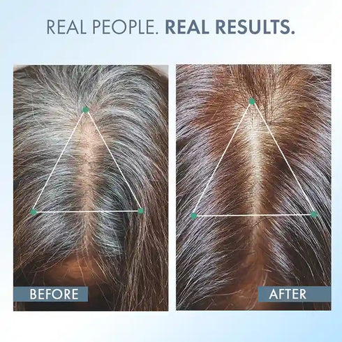 Thriveco Anti Greying Hair Supplement 30 capsules