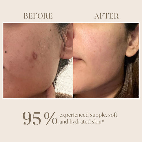 Ohria Ayurveda Kumkumadi Skin Brightening Elixir