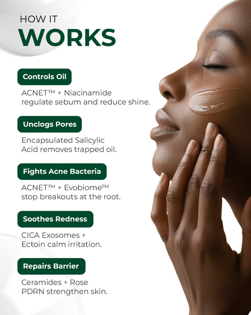Aqueria Mini Oil Control Moisturizer