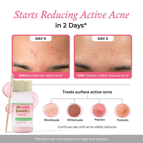 The Pink Foundry Overnight Acne Spot Corrector for Men 30 ml