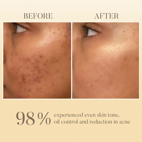 Ohria Ayurveda Neem & Tulsi Face Wash