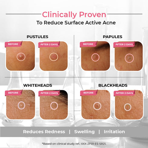 The Pink Foundry Overnight Acne Spot Corrector for Men 30 ml