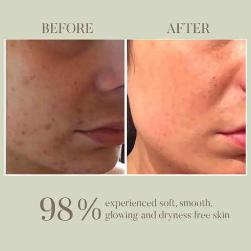 Ohria Ayurveda Shrikamya Facial Beauty Oil