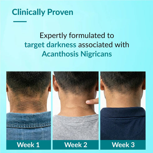 FixDerma Fixderma Skincare Nigrifix Advance Cream